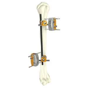 External Fixator